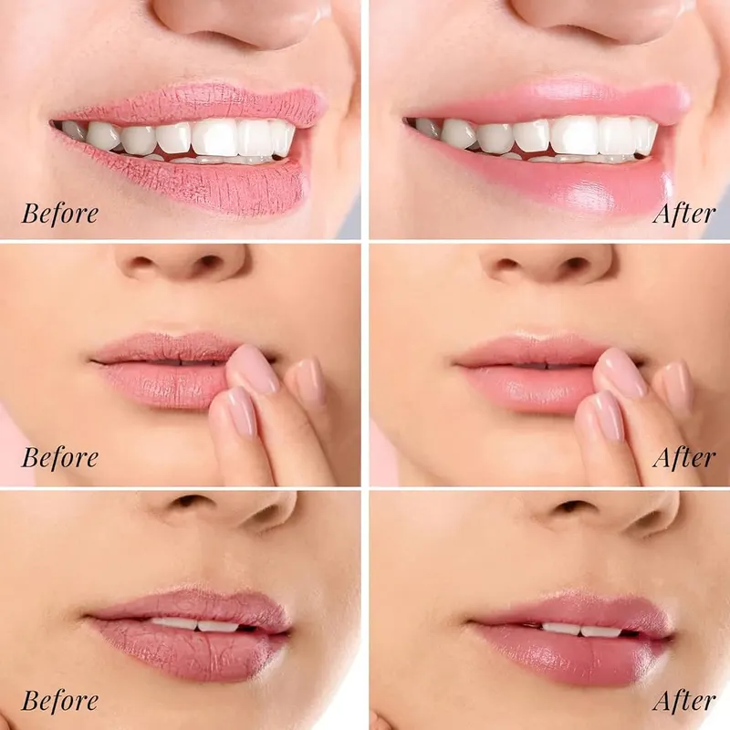 ANRCOLLECT 4-Pack Lip Scrub and Lip Mask – Coupon plus promo code