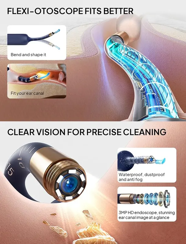Yumika Ear Wax Removal Tool Camera – 1080P camera ear cleaning kit