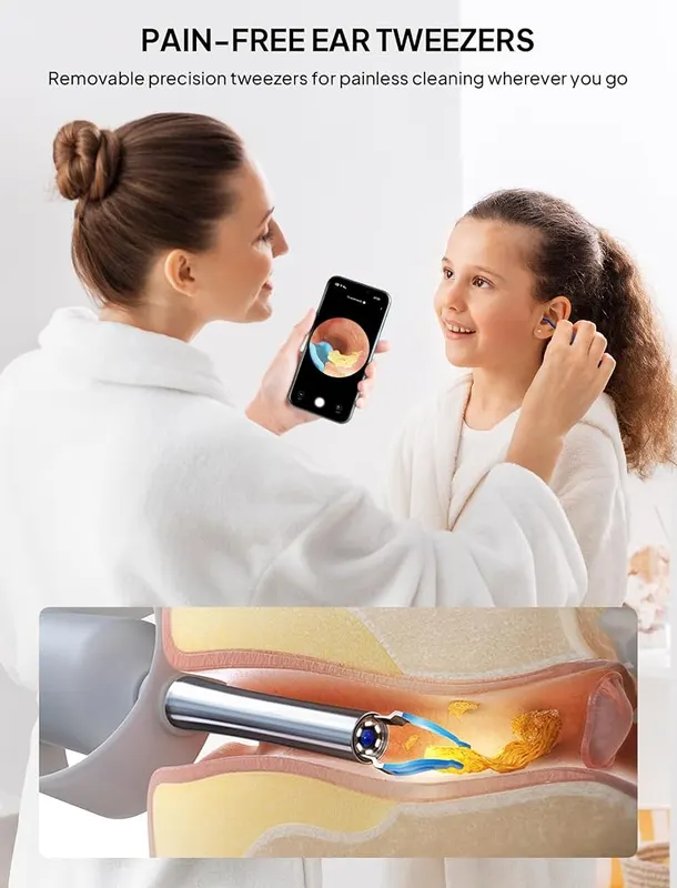 Yumika Ear Wax Removal Tool Camera – Flexible otoscope with light