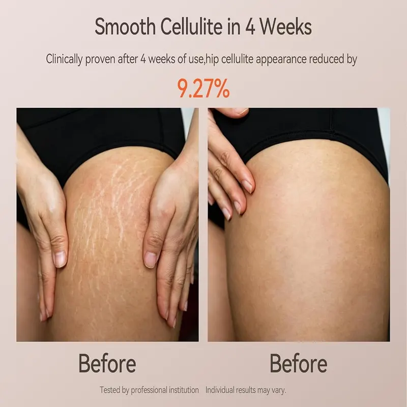 Zelvory 3-in-1 Body Sculpting Machine – Combines vacuum suction massage technology